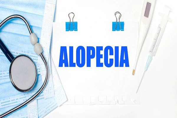 What to do about Alopecia in young people? 2 What to do about Alopecia in young people?