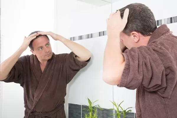 How to treat Dandruff in Men? Natural remedies