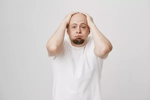 How does Baldness affect Psychologically?
