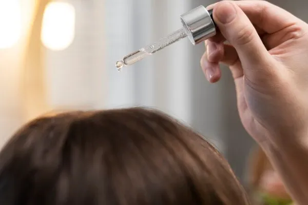 Does dandruff affect hair transplants?