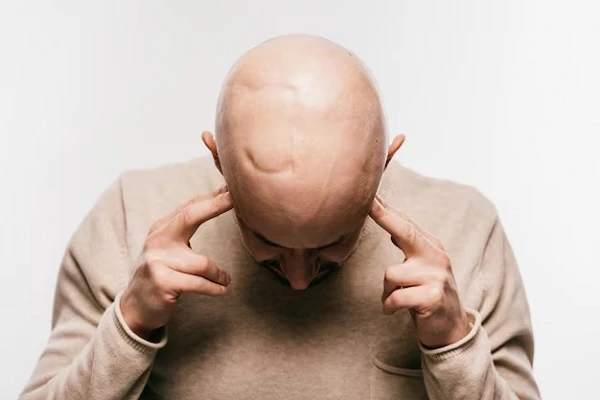 Hair transplant on scars, does it work?