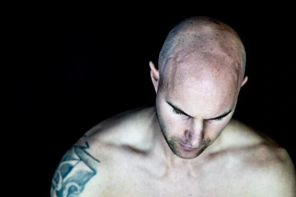 Hair transplant on scars, does it work?