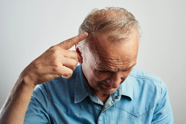 Hair transplant on scars, does it work?