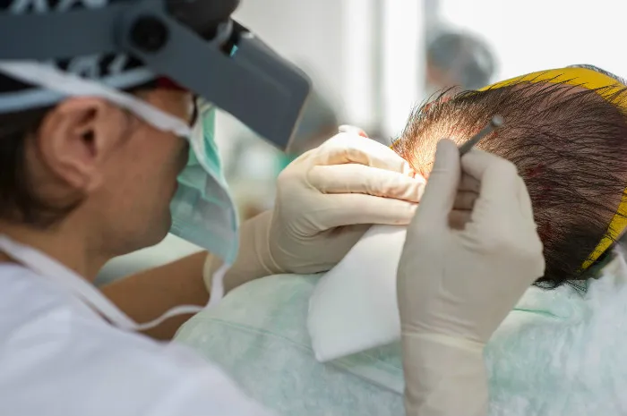 Hair transplant in Turkey, why choose this country? 4 Hair transplant in Turkey, why choose this country?