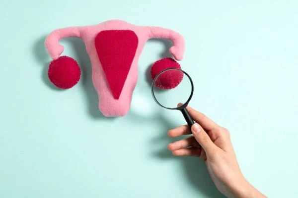 Relationship between Polycystic Ovary Syndrome and hair loss 2 Relationship between Polycystic Ovary Syndrome and hair loss