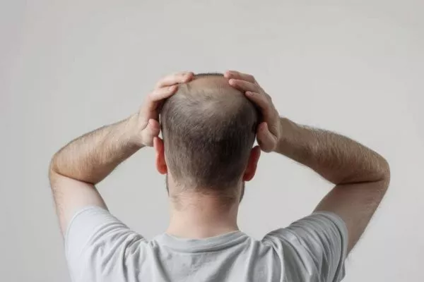 Hair Laser Therapy: How does it work? 5 Hair Laser Therapy: How does it work?