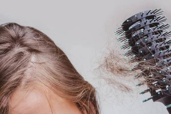 Styling your hair causes Baldness? Tips to avoid it