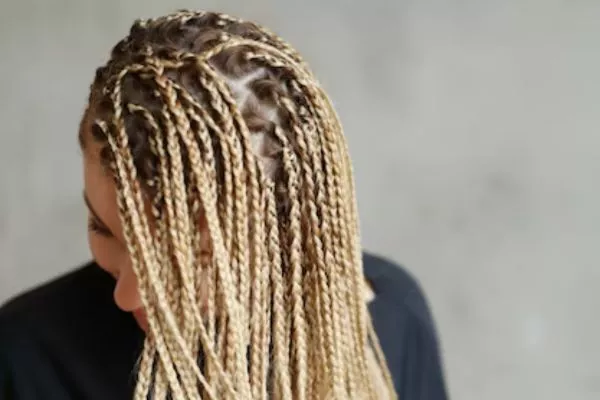 Styling your hair causes Baldness? Tips to avoid it