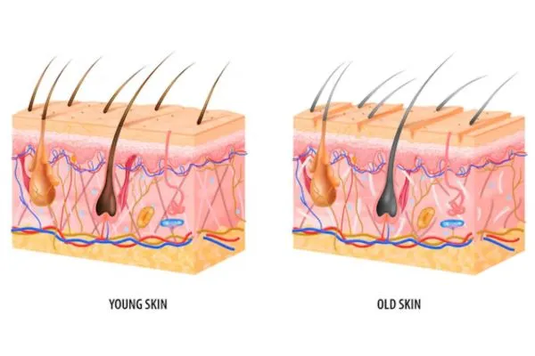 Is the hair transplant permanent?