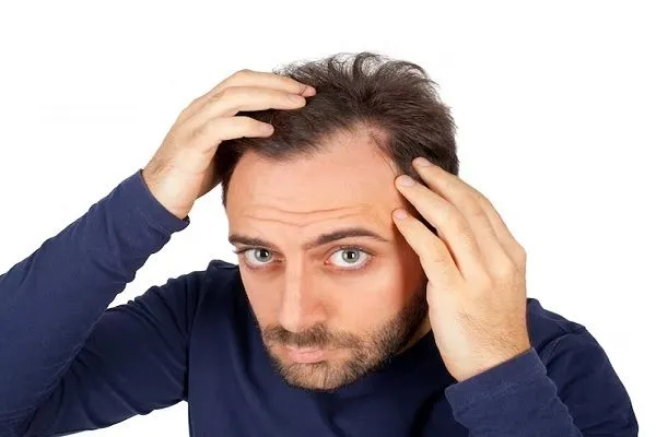 Los problemas más comunes del cabello y su solución 5 Los problemas más comunes del cabello y su solución