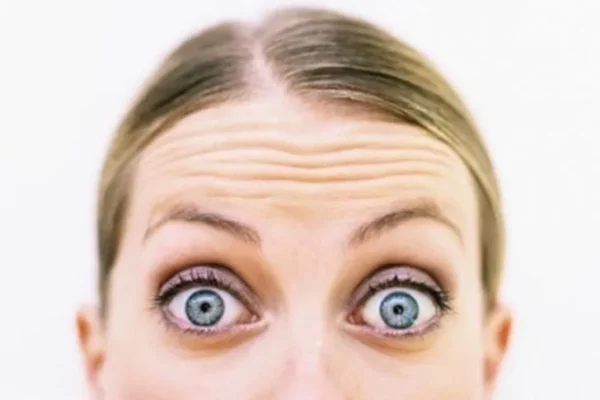 Alopecia, un problema al que no es ajeno nadie