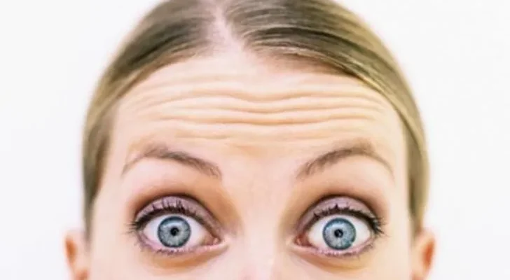 Alopecia, un problema al que no es ajeno nadie
