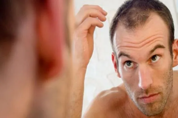 Los problemas más comunes del cabello y su solución 2 Los problemas más comunes del cabello y su solución