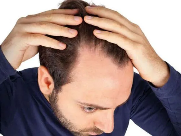 Top 3 pastillas para la caída del pelo 2 Top 3 pastillas para la caída del pelo
