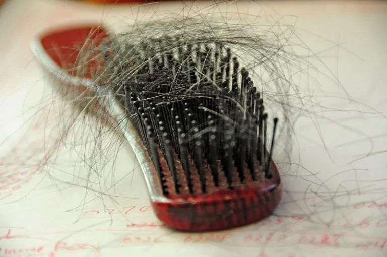 Famosas que sufren alopecia