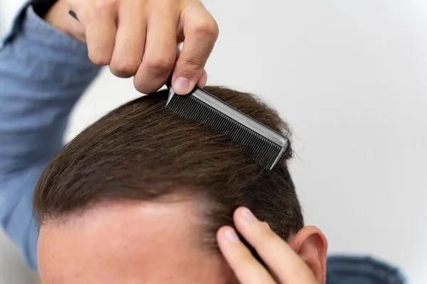 Comment éviter la chute des cheveux, que faut-il prendre, peut-on l’éviter?