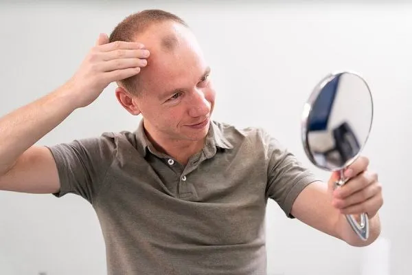 Comment éviter la chute des cheveux, que faut-il prendre, peut-on l’éviter?