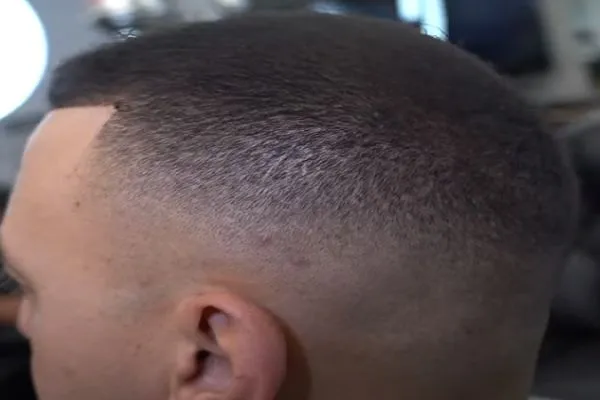 Cortes de pelo para calvos 2 Cortes de pelo para calvos