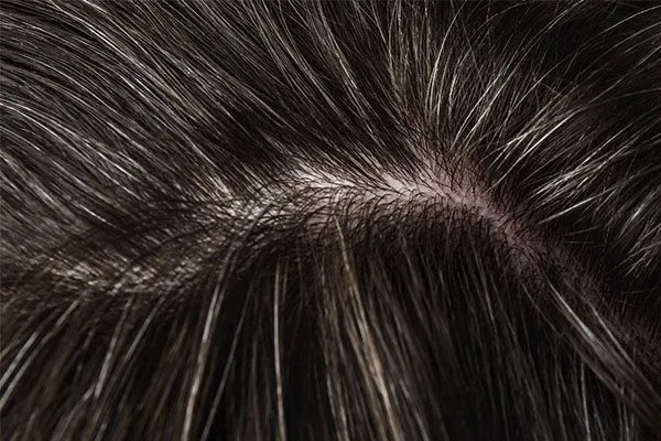 Ronquina, qu’est-ce que c’est et à quoi ça sert ? 4 Ronquina, qu’est-ce que c’est et à quoi ça sert ?