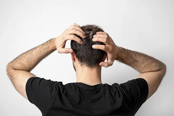 Effet « Shedding » 5 Effet « Shedding »