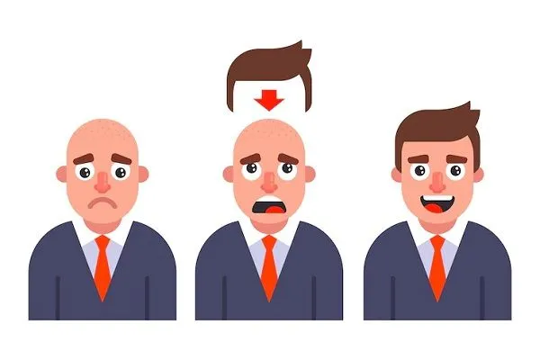 Sistema de integración capilar ¿En qué consiste?