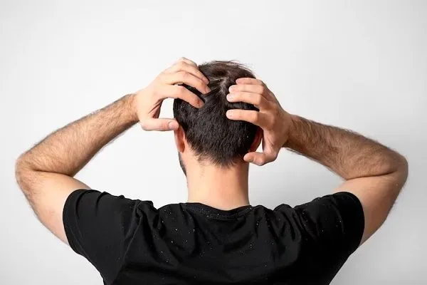 Aceite de aguacate para el cabello, ¿cuáles son sus beneficios? 5 Aceite de aguacate para el cabello, ¿cuáles son sus beneficios?