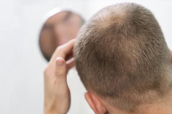 Effet « Shedding »