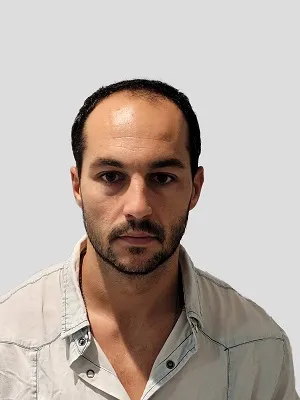 Cómo planificar una operación capilar