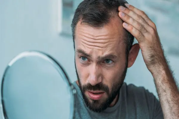 ¿De quién se hereda la calvicie? 2 ¿De quién se hereda la calvicie?