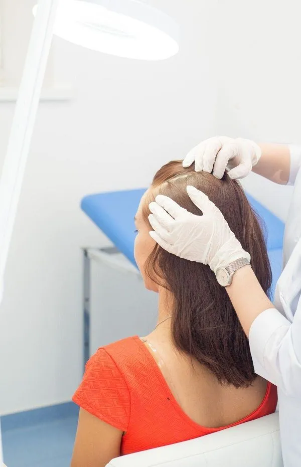 Alopecia en mujeres conozca todos los secretos