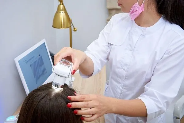 Alopecia en mujeres conozca todos los secretos