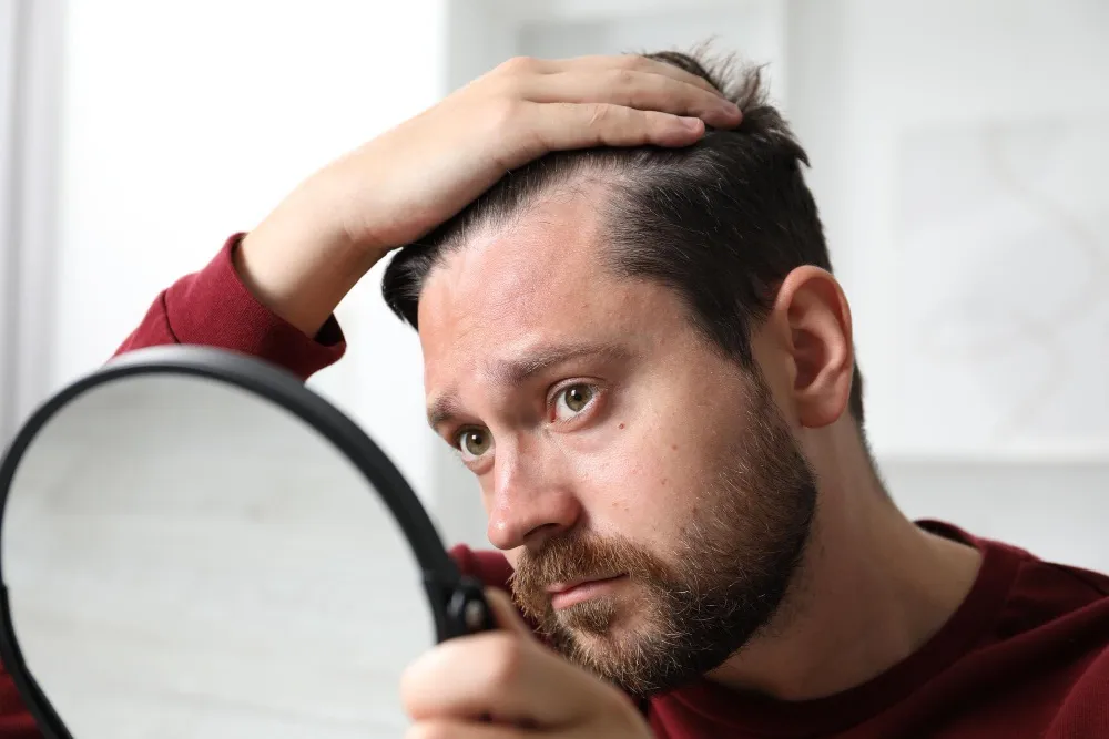 Problemas psicológicos que pueden derivar de la alopecia 4 Problemas psicológicos que pueden derivar de la alopecia