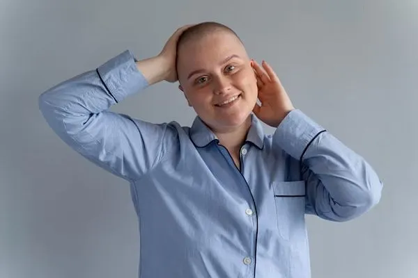 Alopecia prematura, ¿qué es?