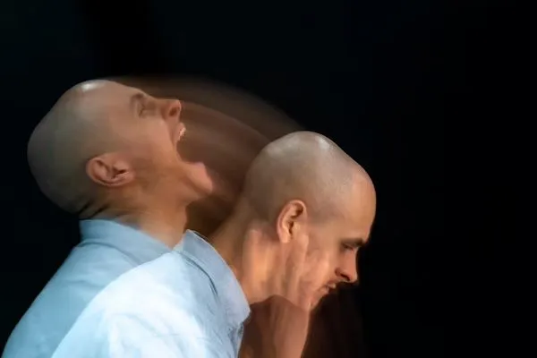 Alopecia prematura, ¿qué es? 2 Alopecia prematura, ¿qué es?