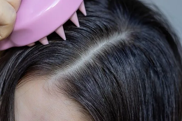 Relación entre alopecia y circulación sanguínea