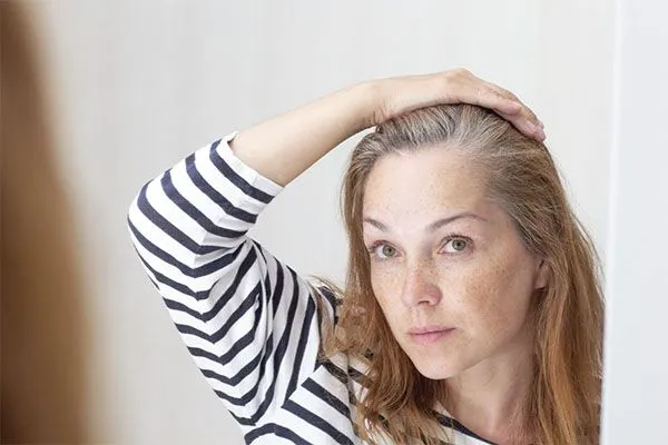 Coiffures pour femmes avec alopécie frontale 2 Coiffures pour femmes avec alopécie frontale