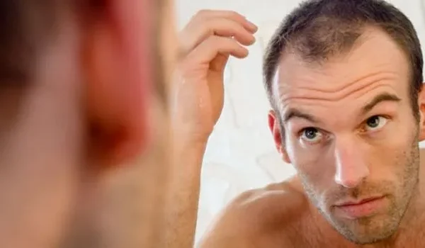 A qué edad suele empezar a caerse el pelo