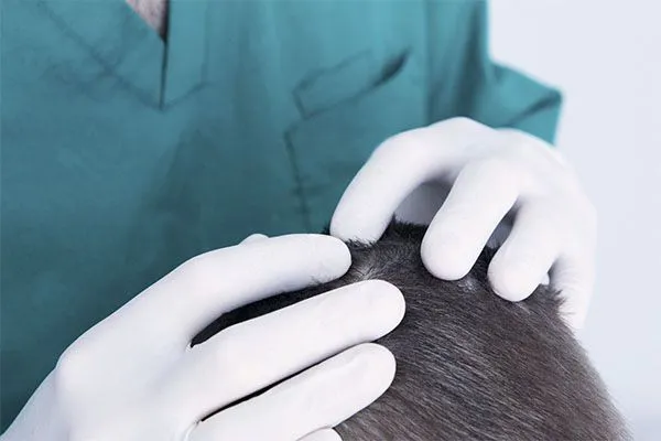 Chirurgien Greffe Cheveux : Comment Choisir le Meilleur Spécialiste ?