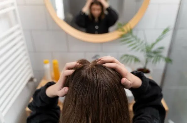 Consecuencias psicológicas de la alopecia