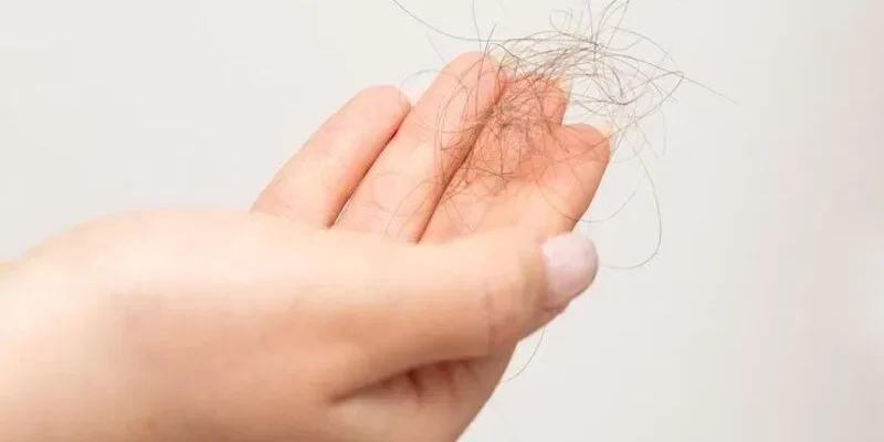 Le syndrome des ovaires polykystiques et la perte de cheveux sont-ils liés ?