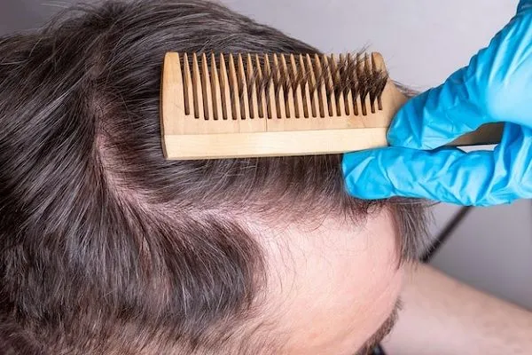 Efecto Shedding, ¿perjudica nuestro cabello?