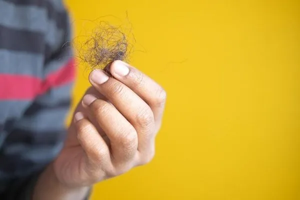 Finasteride vs. Minoxidil: Guía médica sobre eficacia, dosis y efecto shedding 4 Finasteride vs. Minoxidil: Guía médica sobre eficacia, dosis y efecto shedding