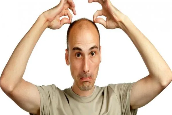 ¿De quién se hereda la calvicie? 5 ¿De quién se hereda la calvicie?