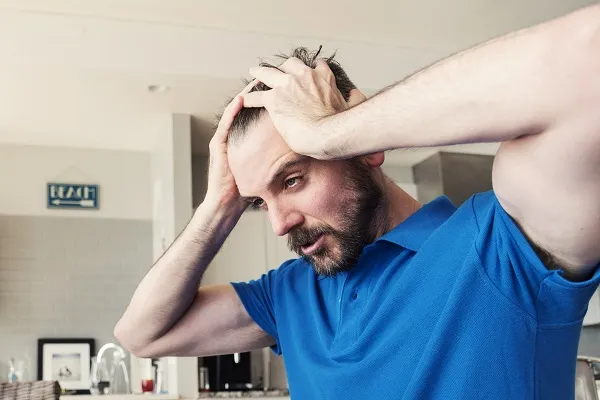 Todo sobre la alopecia: causas, tipos, diagnóstico y tratamientos médicos 7 Todo sobre la alopecia: causas, tipos, diagnóstico y tratamientos médicos