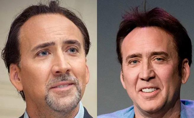 El injerto capilar cada vez tiene más adeptos en Hollywood 3 El injerto capilar cada vez tiene más adeptos en Hollywood