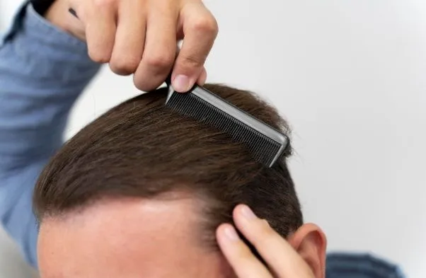 La tecnología láser como tratamiento para la alopecia