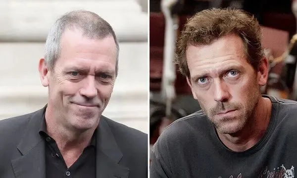 El injerto capilar cada vez tiene más adeptos en Hollywood 10 El injerto capilar cada vez tiene más adeptos en Hollywood