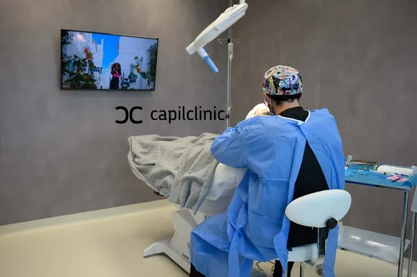 Los implantes capilares, ¿son eficaces? 2 Los implantes capilares, ¿son eficaces?