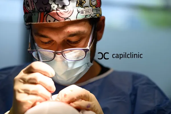 Los implantes capilares, ¿son eficaces?