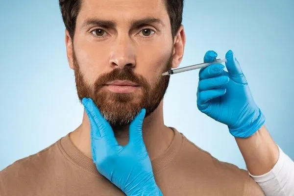 Injerto de barba, ¿por qué se lleva a cabo?